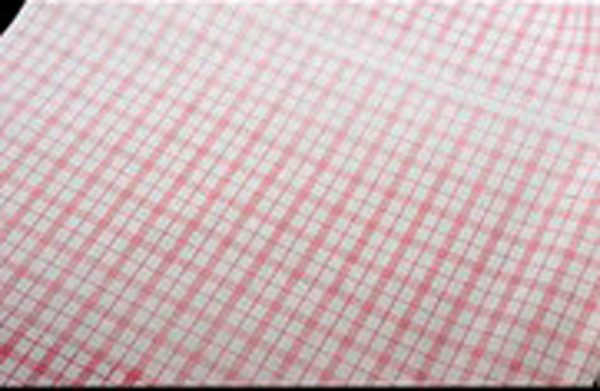 ΡΙΖΟΧΑΡΤΟ ΚΑΡΩ 20Χ30ΕΚ 10ΚΓΡ